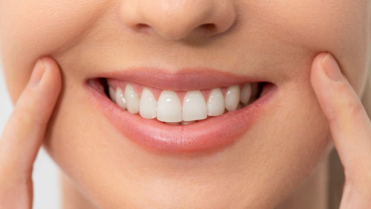 Before and After: Homemade Teeth Whitening Recipe With Baking Soda