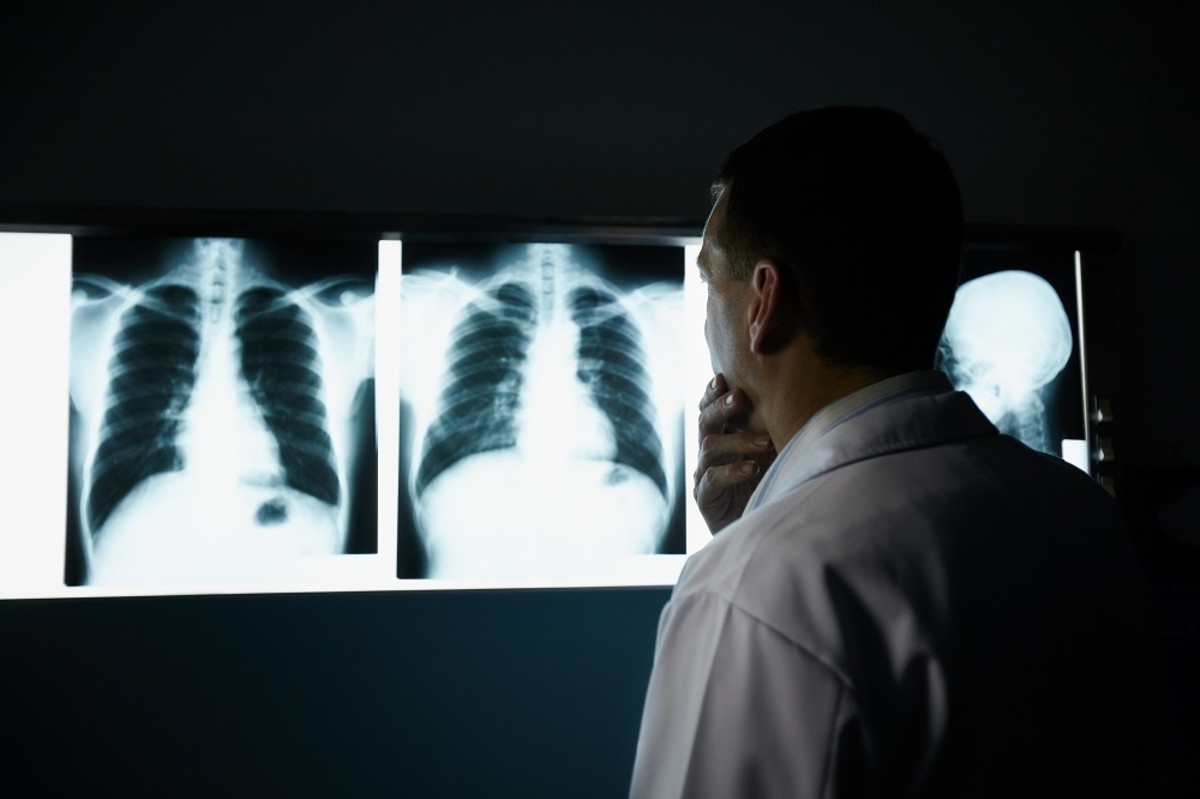 Why Patient Education is Crucial in X- Ray Procedures