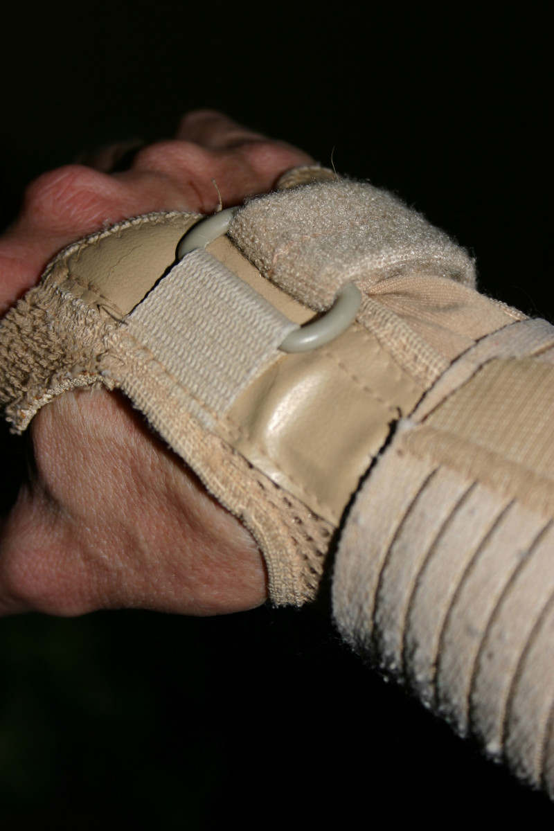 Natural Treatments For Carpal Tunnel Syndrome