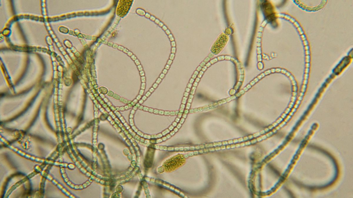 What Are Cyanobacteria, and How Are They Similar or Different From Plants?