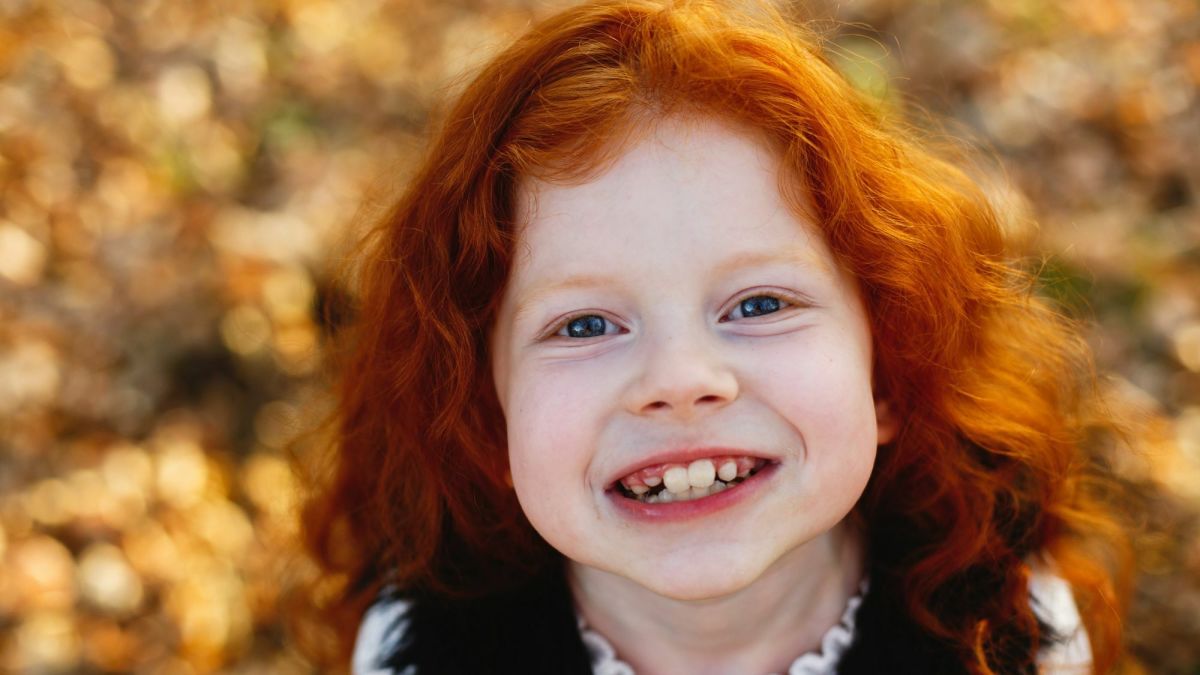 Redheads: The Genetics of Hair Color