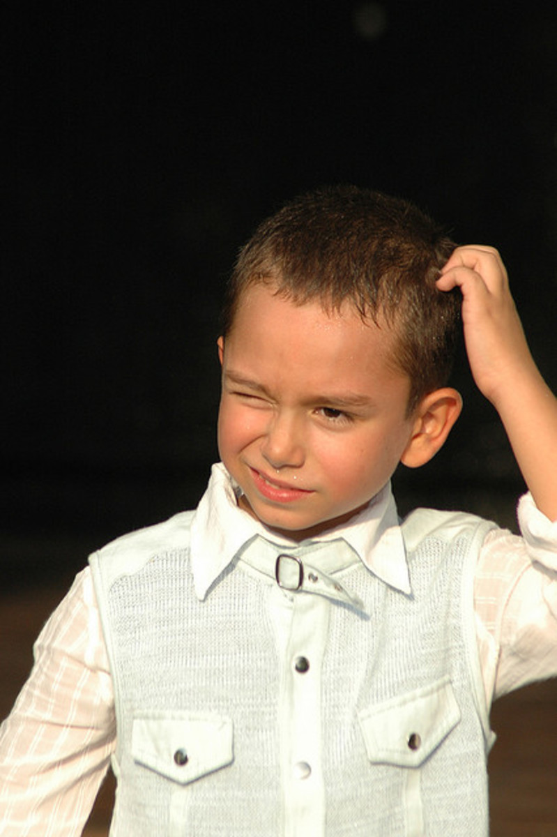 How to Get Rid Of Dandruff - Tips and Remedies