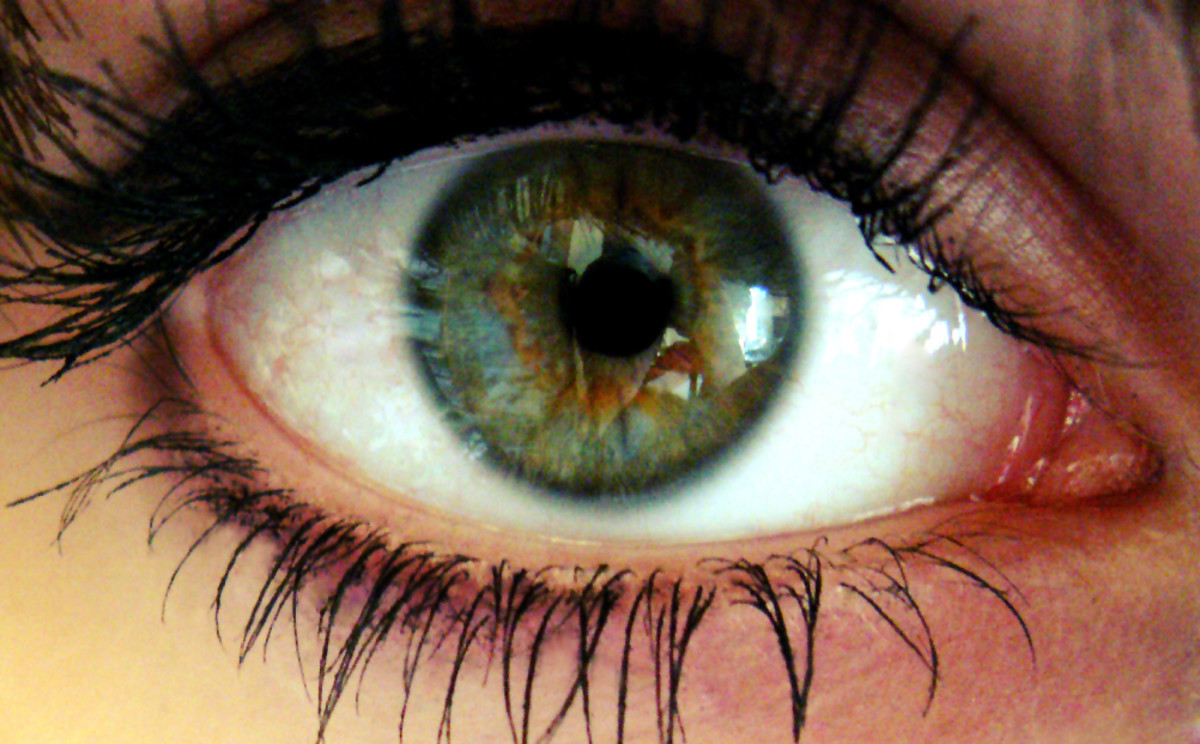 Having Lasik Eye Surgery?