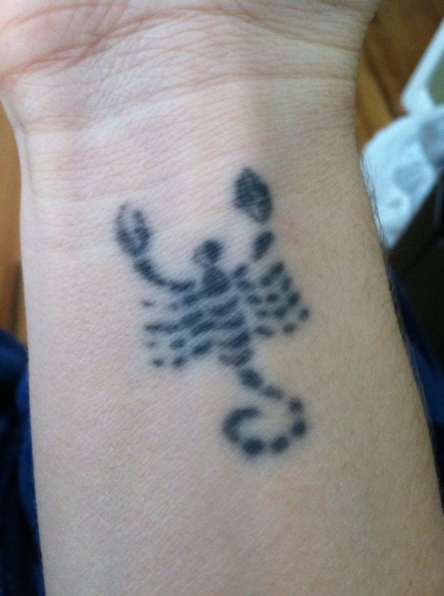 What Does Laser Tattoo Removal Feel Like?