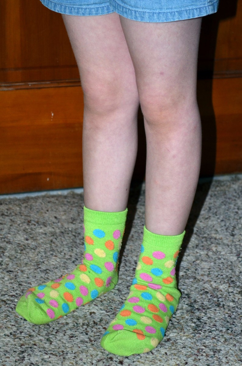 What is Restless Leg Syndrome?