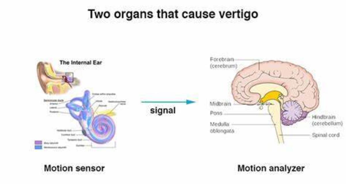 Vertigo is a Spinning Experience You Never Want to Experience.