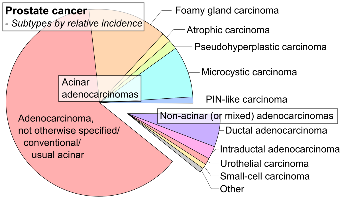 What You Need to Know About Prostate Cancer