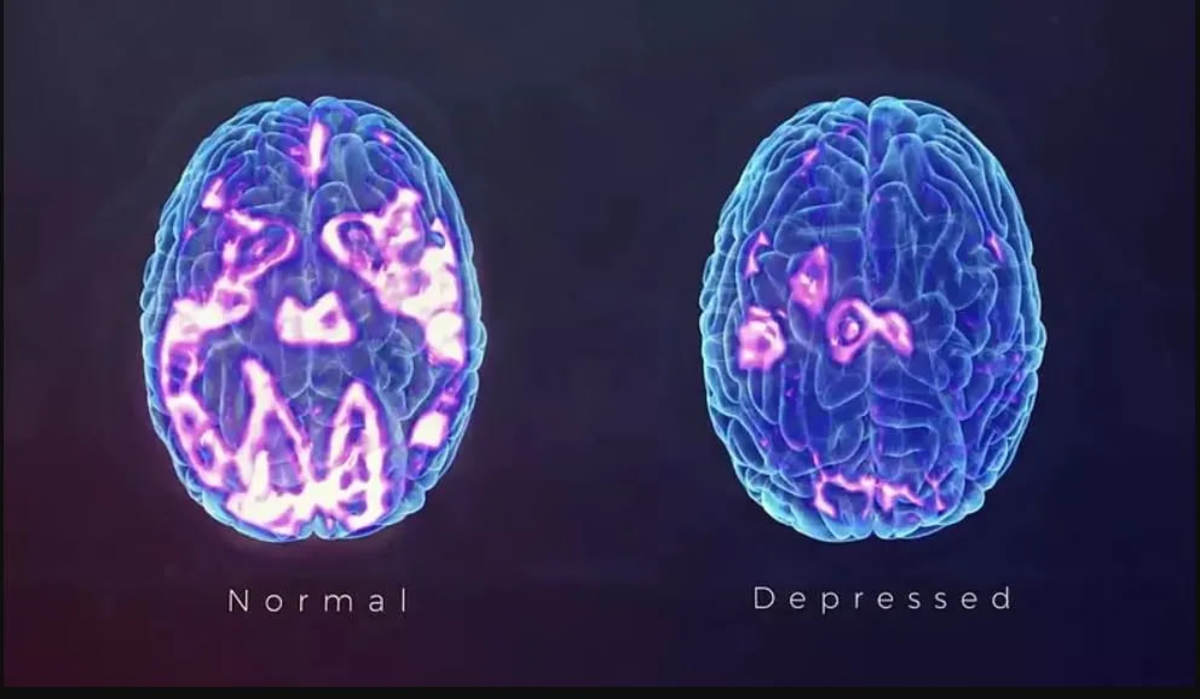 How Depression Silently Affects Your Body: What You Need to Know
