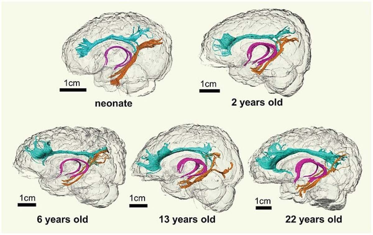 Brain Biology: Development of Frontal Lobes in Infants and Children