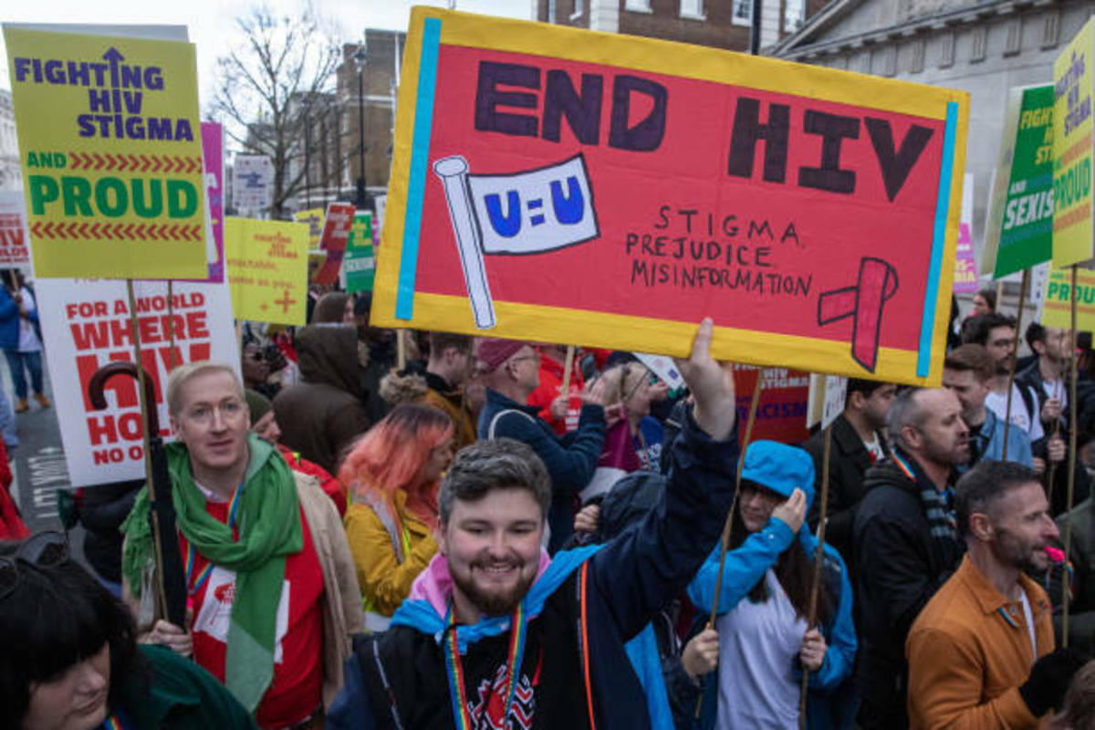 A Timeline on AIDS - HubPages